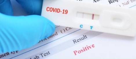 11 049 са новите случаи на коронавирус у нас Висок
